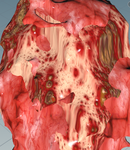 lung10