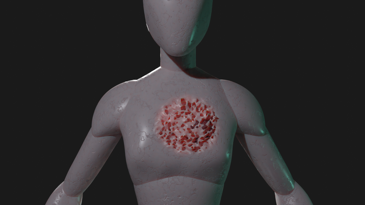 lung7